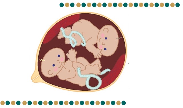 accouchement jumeaux