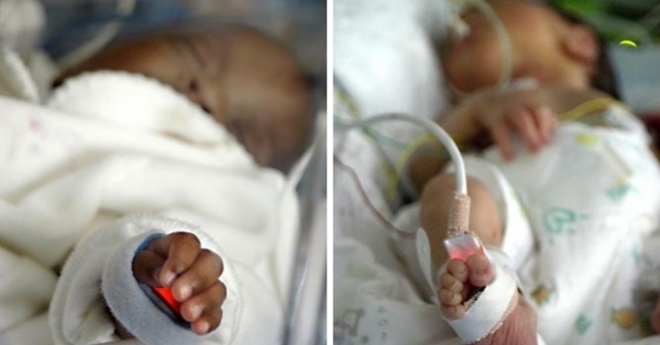 Maternité : Grossesses à hauts risques Hospitalisation de jour